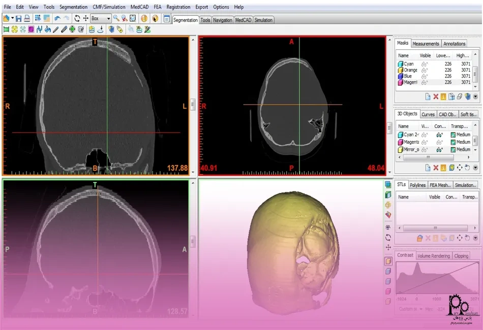 مقایسه نرم افزار میمیکس با سایر نرم افزارها